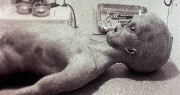 Roswell Autopsy