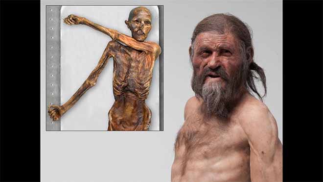 Ötzi The Iceman Or The Similaun Man